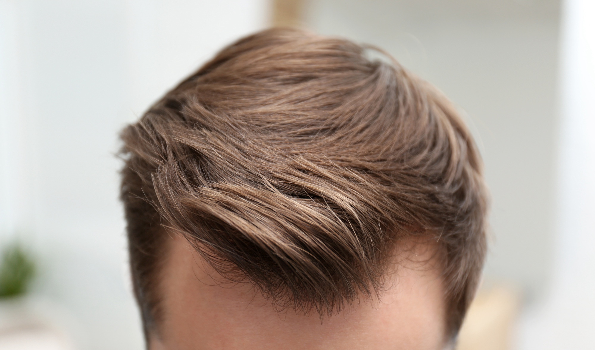 Closeup on a man's hair and hairline