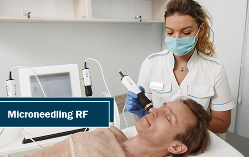 Microneedling RF Woodlands TX