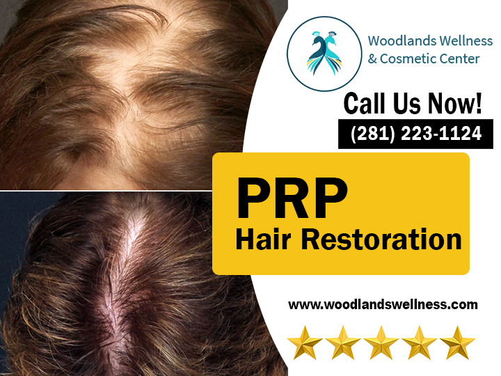 PRP Hair Restoration The Woodlands TX