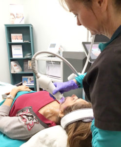 Microneedling RF Woodland TX