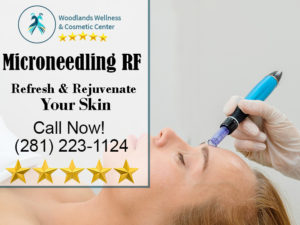 RF Microneedling The Woodlands TX