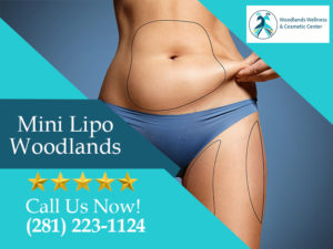 Mini Lipo The Woodlands TX