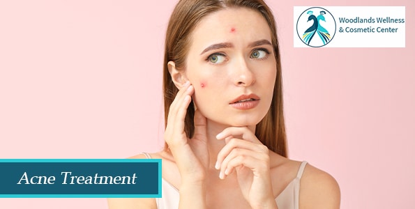 Acne Treatment The Woodlands TX