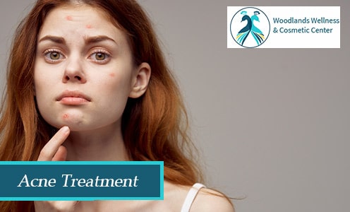 acne treatment woodlands TX