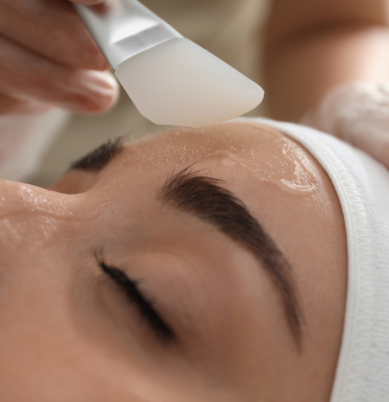 Photo of a woman getting a chemical peel