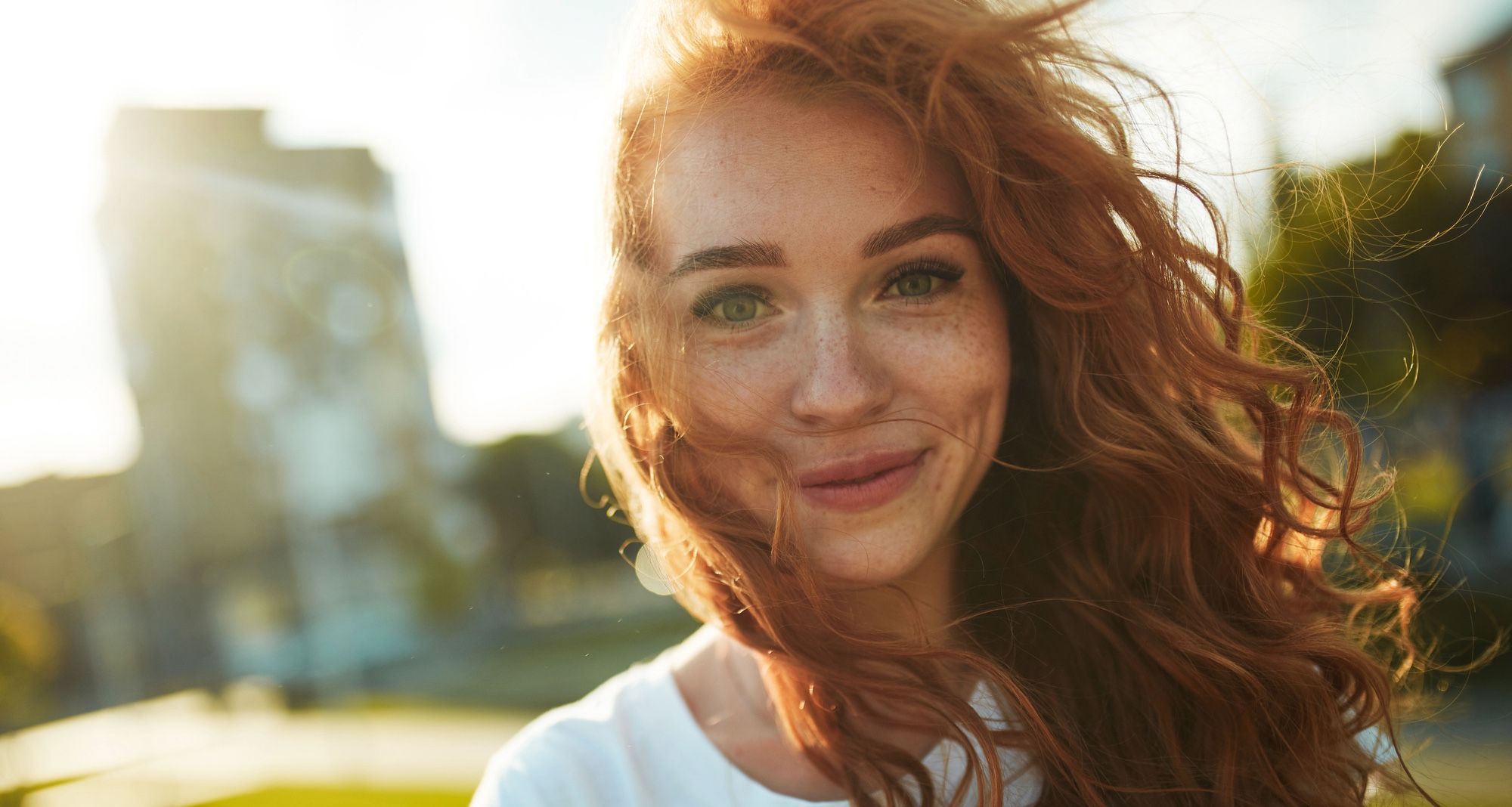 Photo of a redheaded woman with freckles before a hyperpigmentation treatment