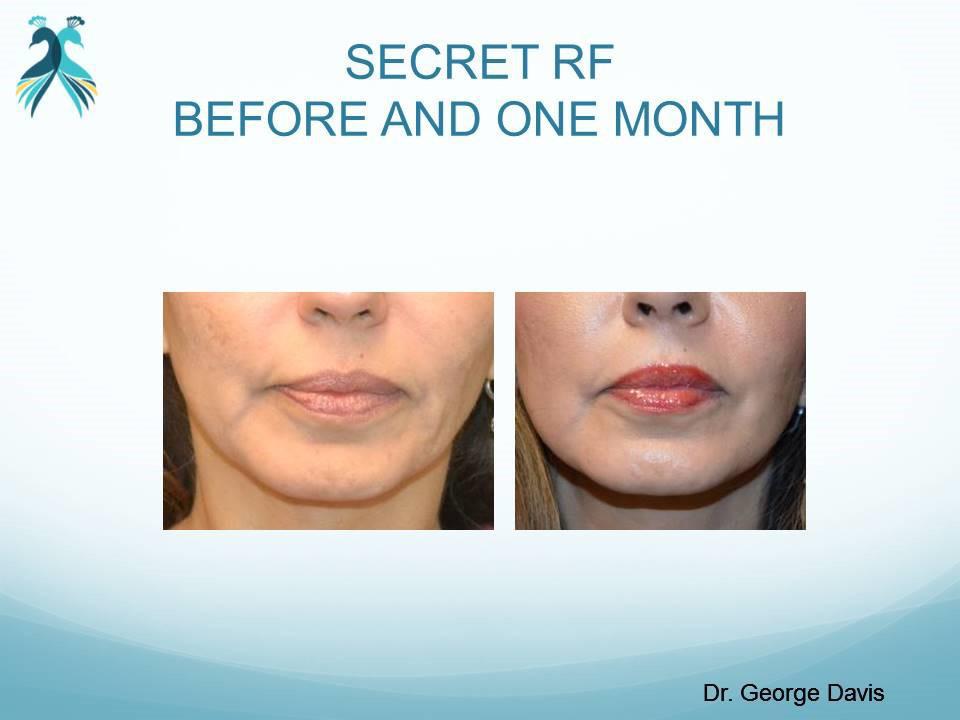 Category: Men’s Health